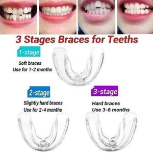 3-Piece Teeth Brace Corrector and Aligner Set